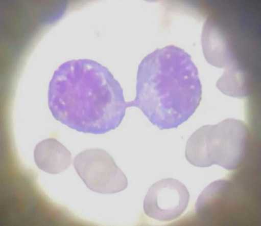 Release from the bone marrow of twin sister cells in telophase cellular division