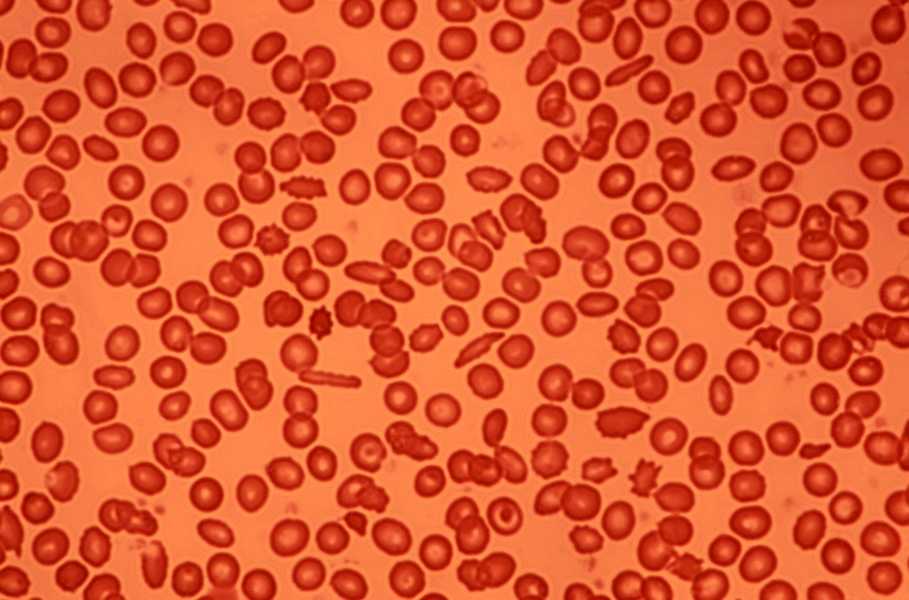 Human blood cells photographed using a microscope